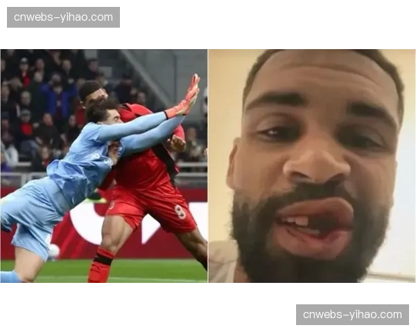 奇克遭遇牙槽骨骨折，米兰中场大将将缺席关键比赛